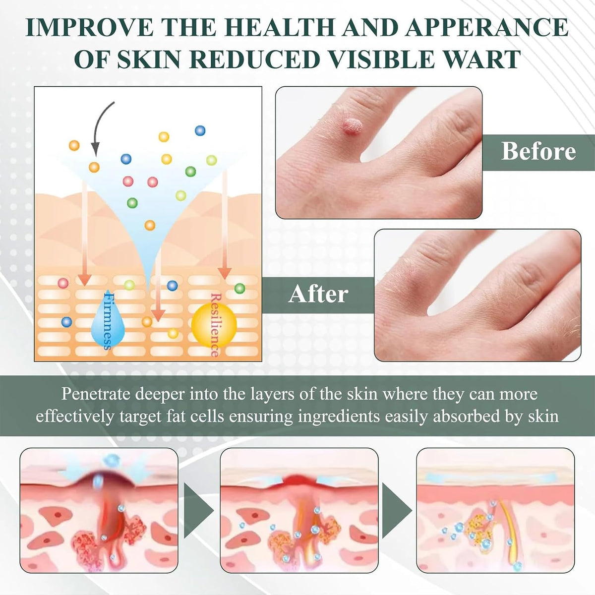 Luhaka® NATURESTORE Instant Mole & Spot Gel
