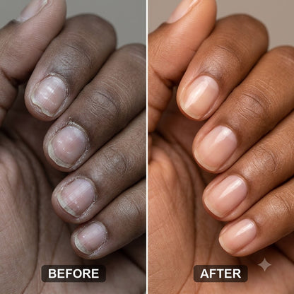 Collagen Peptides & Vitamin C – 300g Marine Collagen Powder for Skin, Nails, Hair & Joints